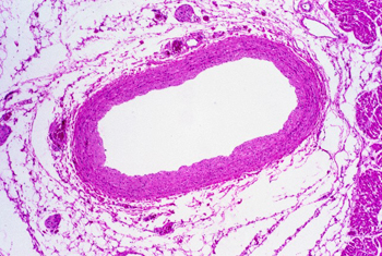 http://drtihanyi.hu/uploads/coronary2.jpg
