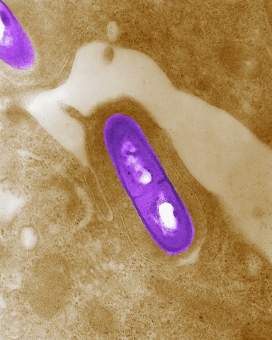 http://drtihanyi.hu/uploads/listeria.jpg